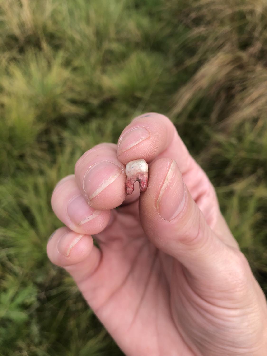 A brown human molar
